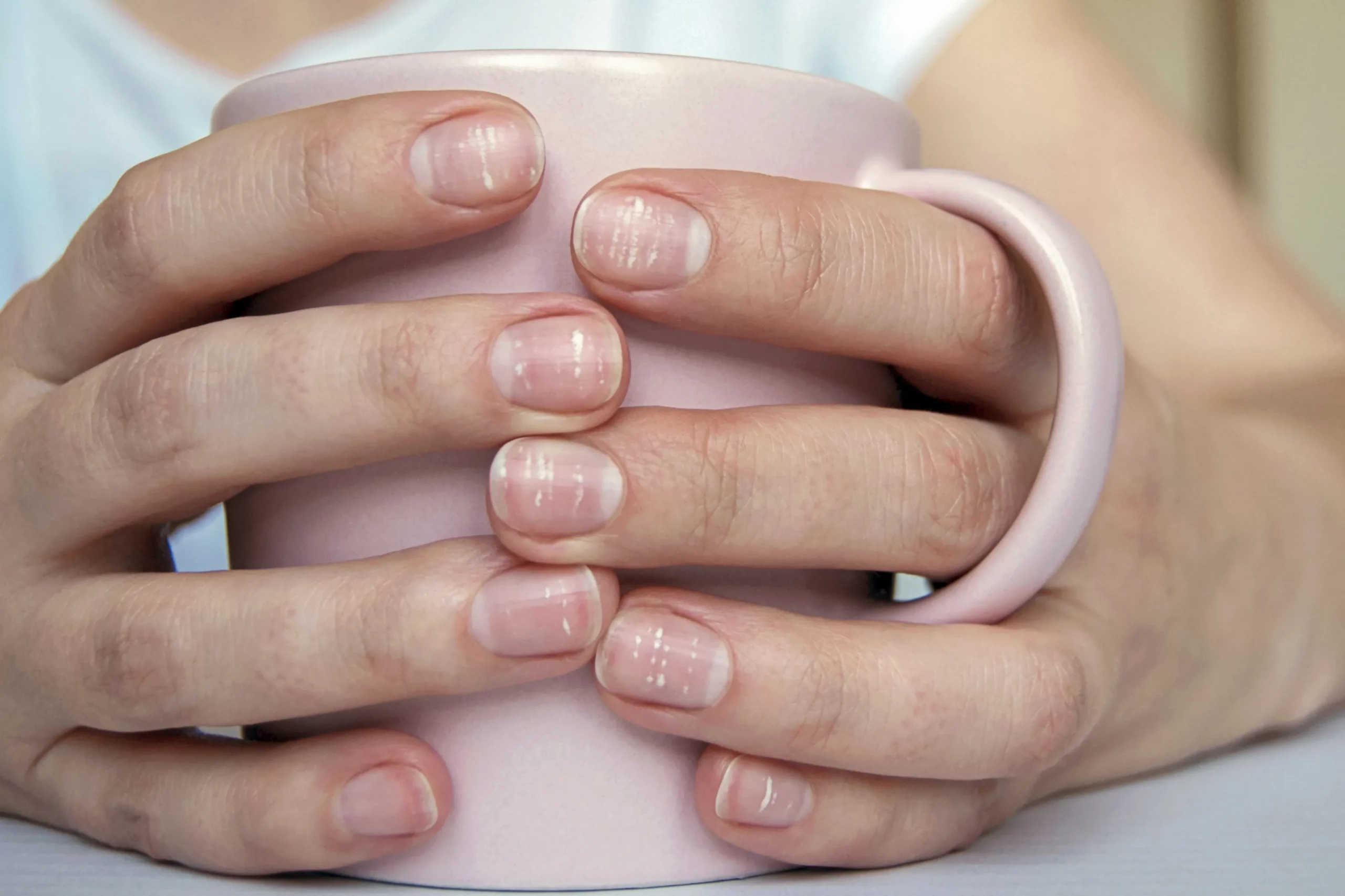 witte vlekjes op nagels